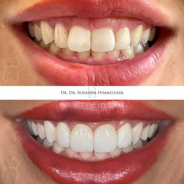 Dental Clinic Lucerne - Emergency Dentist Lucerne gallery image 10