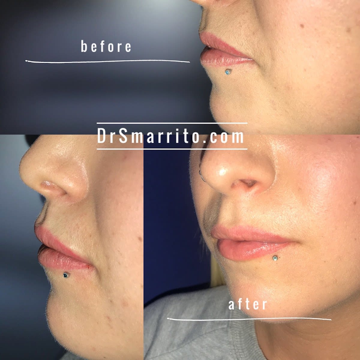 Dr SMARRITO FMH Chirurgie esthétique, médecine et laser esthétique gallery image 4