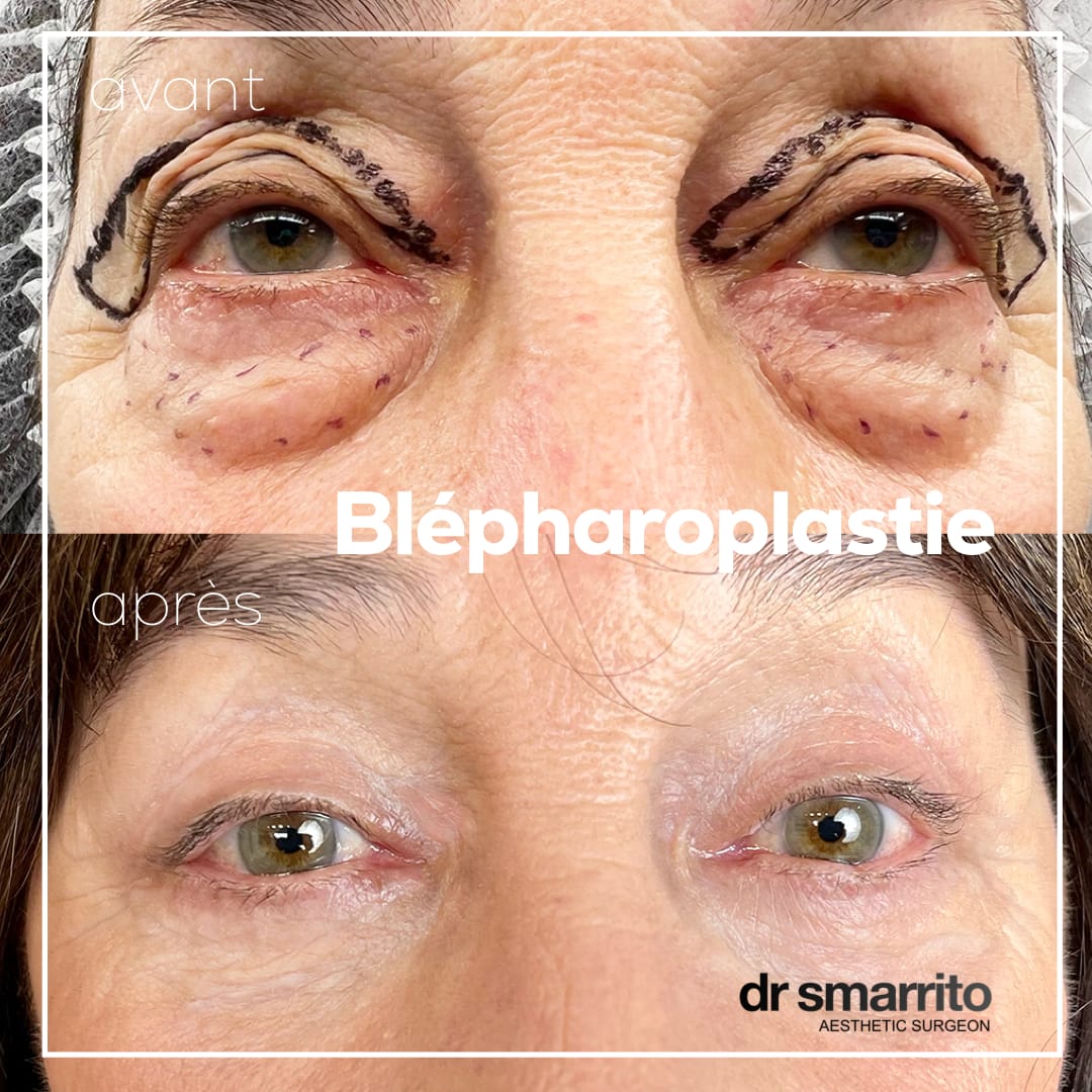 Dr SMARRITO FMH Chirurgie esthétique, médecine et laser esthétique gallery image 5