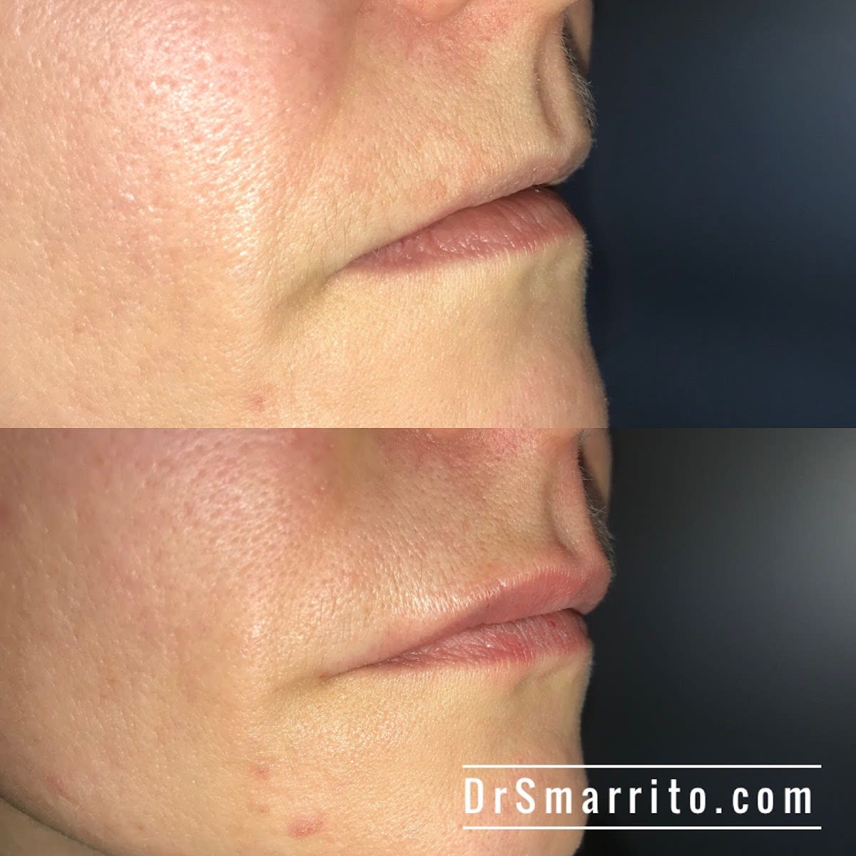 Dr SMARRITO FMH Chirurgie esthétique, médecine et laser esthétique gallery image 6