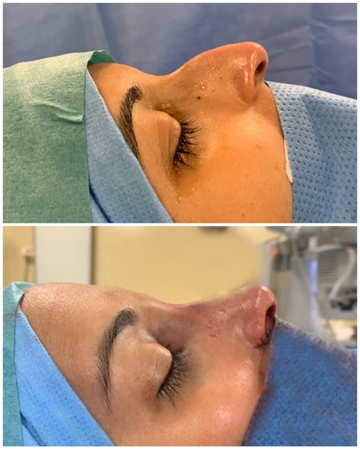 Dr Paolo Montemurro | Chirurgo Plastico Estetico di Varese | Mastoplastica, Addominoplastica, Rinoplastica & Liposuzione gallery image 6