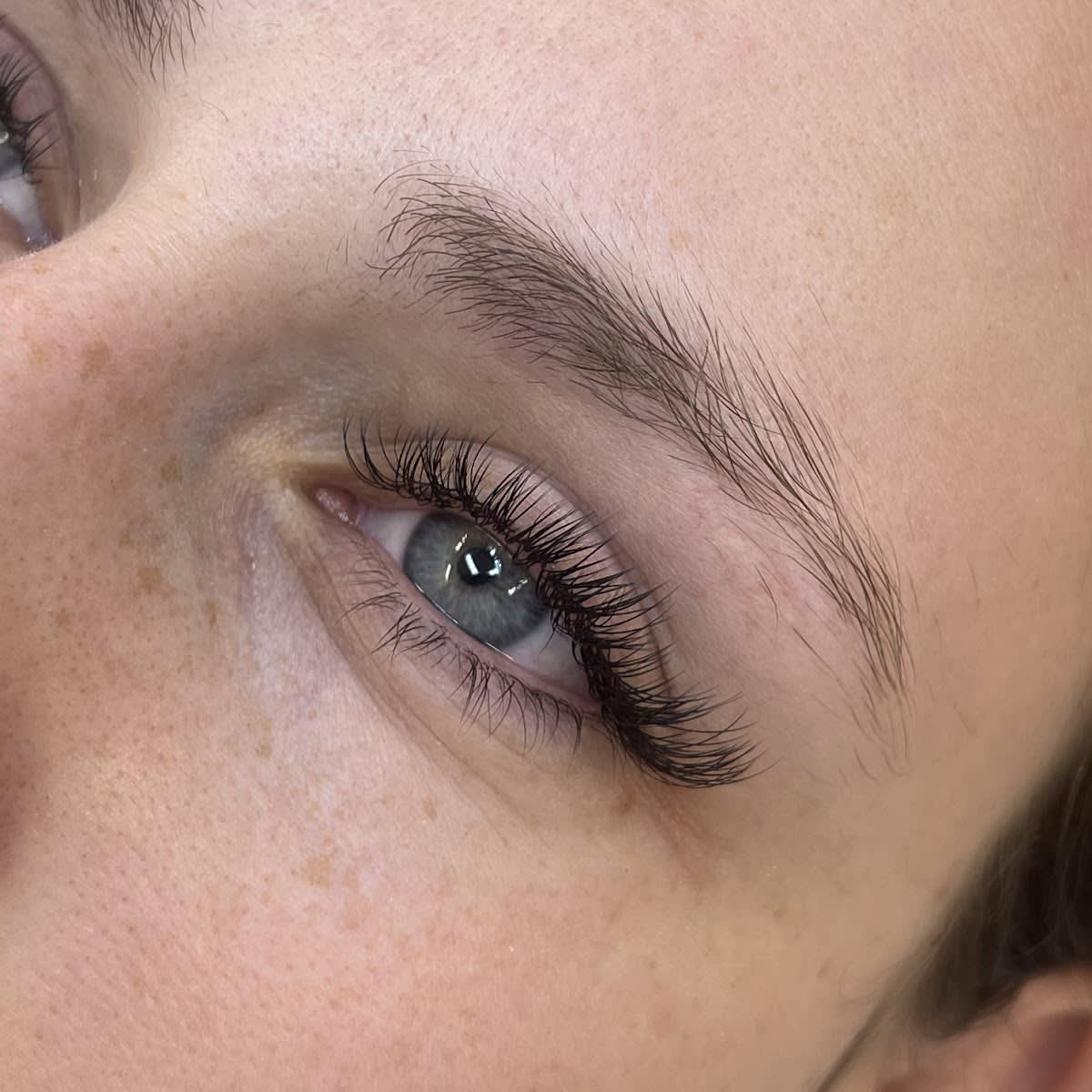 Medical Laser & Beauty AG gallery image 7