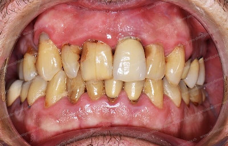 SMILE DESIGNER & DENTOPHOBIA gallery image 4