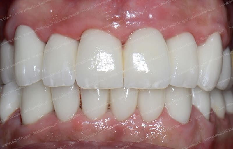 SMILE DESIGNER & DENTOPHOBIA gallery image 5