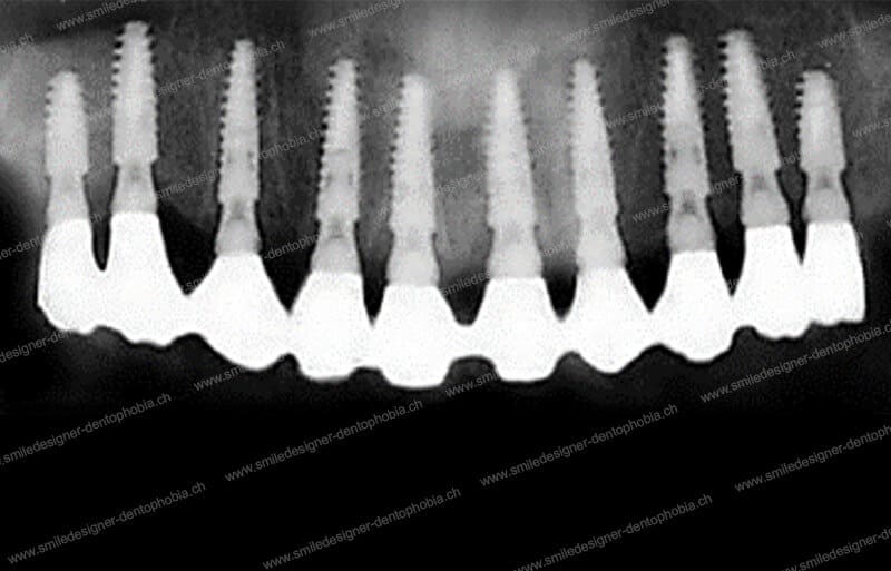 SMILE DESIGNER & DENTOPHOBIA gallery image 6