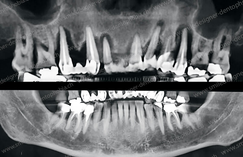 SMILE DESIGNER & DENTOPHOBIA gallery image 8