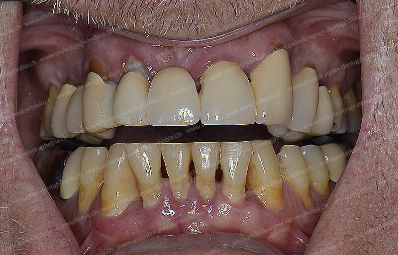 SMILE DESIGNER & DENTOPHOBIA gallery image 9