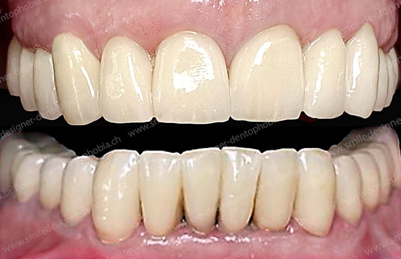 SMILE DESIGNER & DENTOPHOBIA gallery image 10