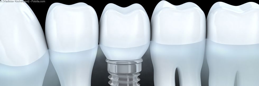 Dr. med. dent. Markus Thaler gallery image 2