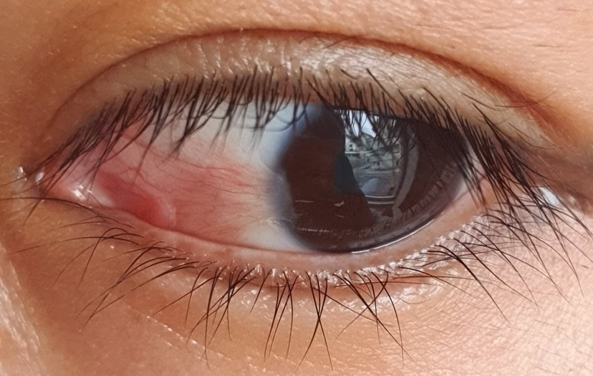 Centre de microchirurgie oculaire - CEMO Lausanne (easylaser) gallery image 7