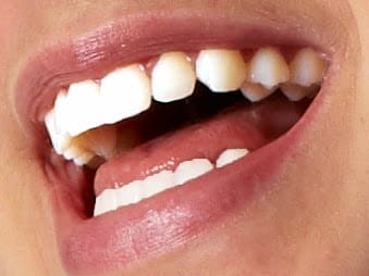 Zahnarztpraxis Dr. Villiger gallery image 8