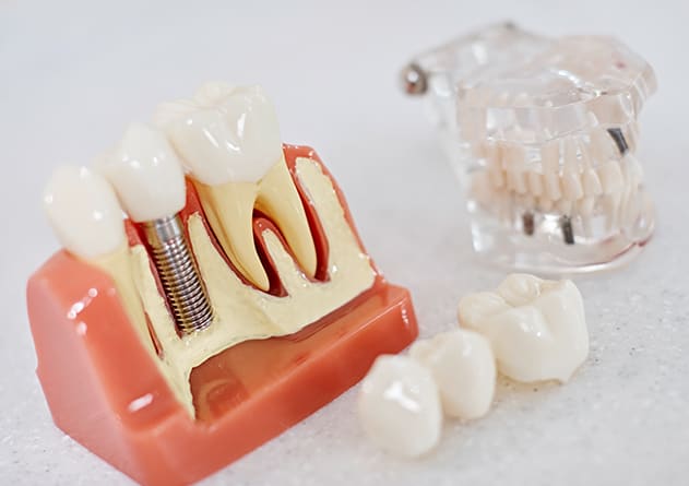 Deutsch - Schweizerische Dentalclinic - Dr. Alexander Herdt und Oleg Plaksin gallery image 7