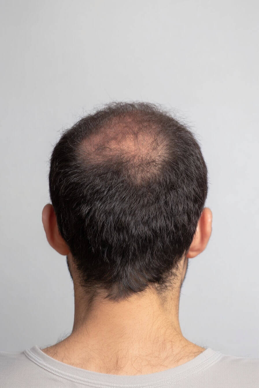 Māra Zürich gallery image 4