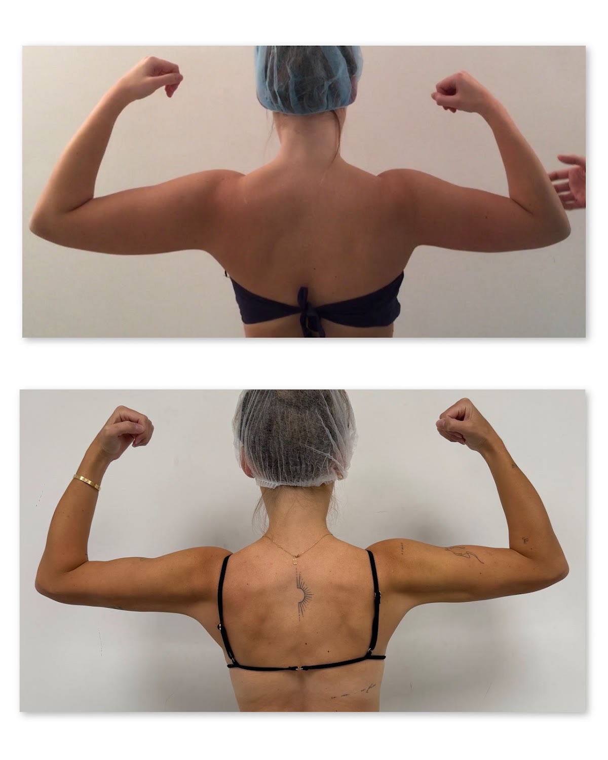 White House Center for Liposuction gallery image 7