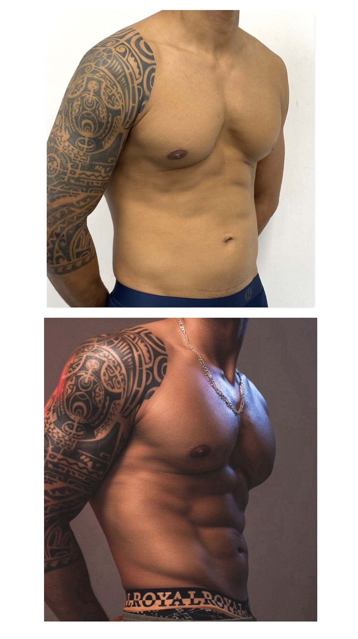 White House Center for Liposuction gallery image 9