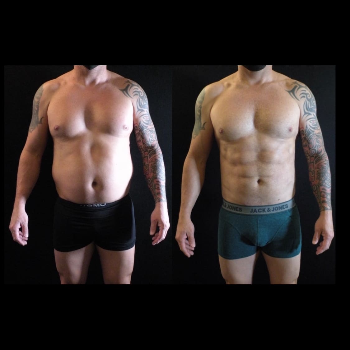 White House Center for Liposuction gallery image 10