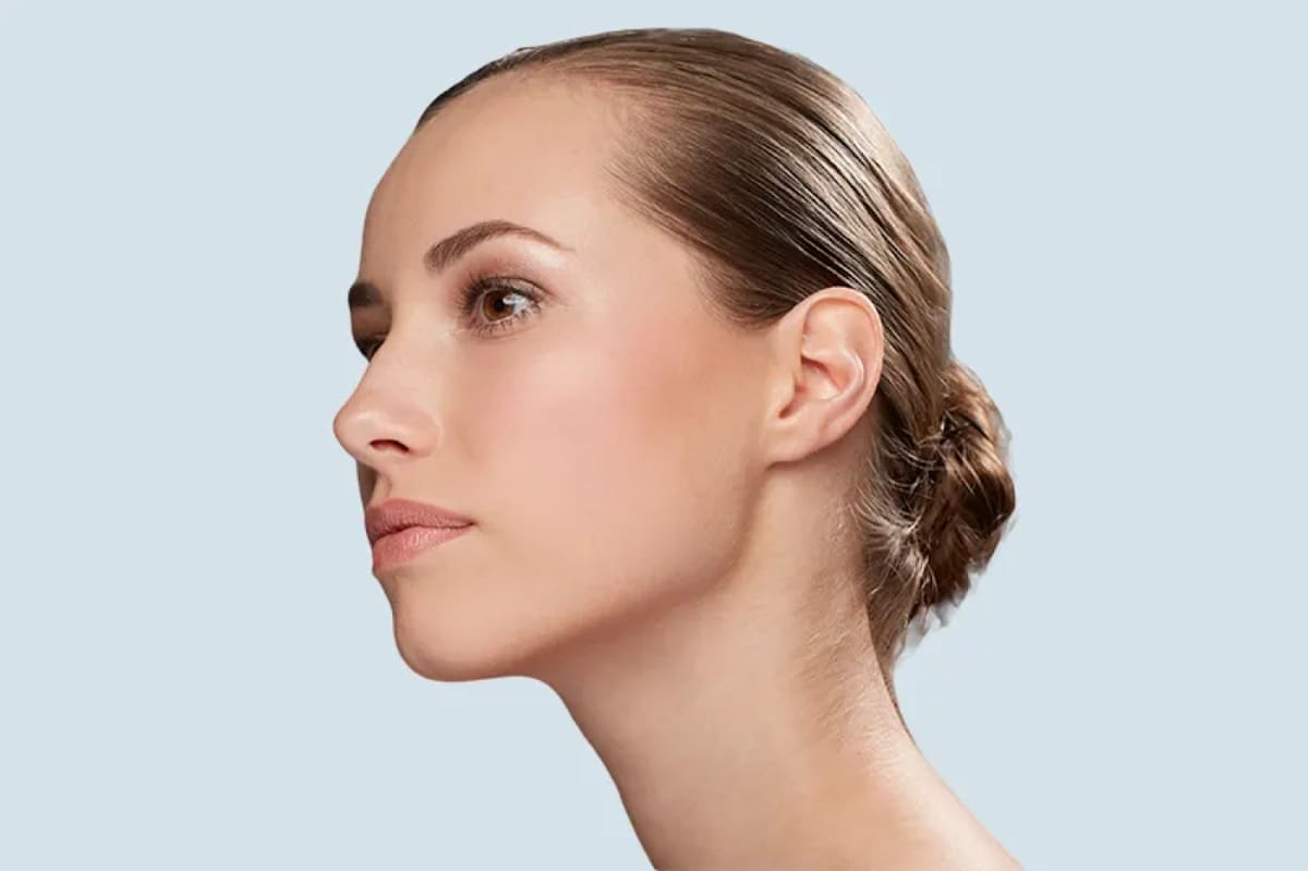 Finesse Institute - Traitements Esthétiques Avancés à Lausanne gallery image 6