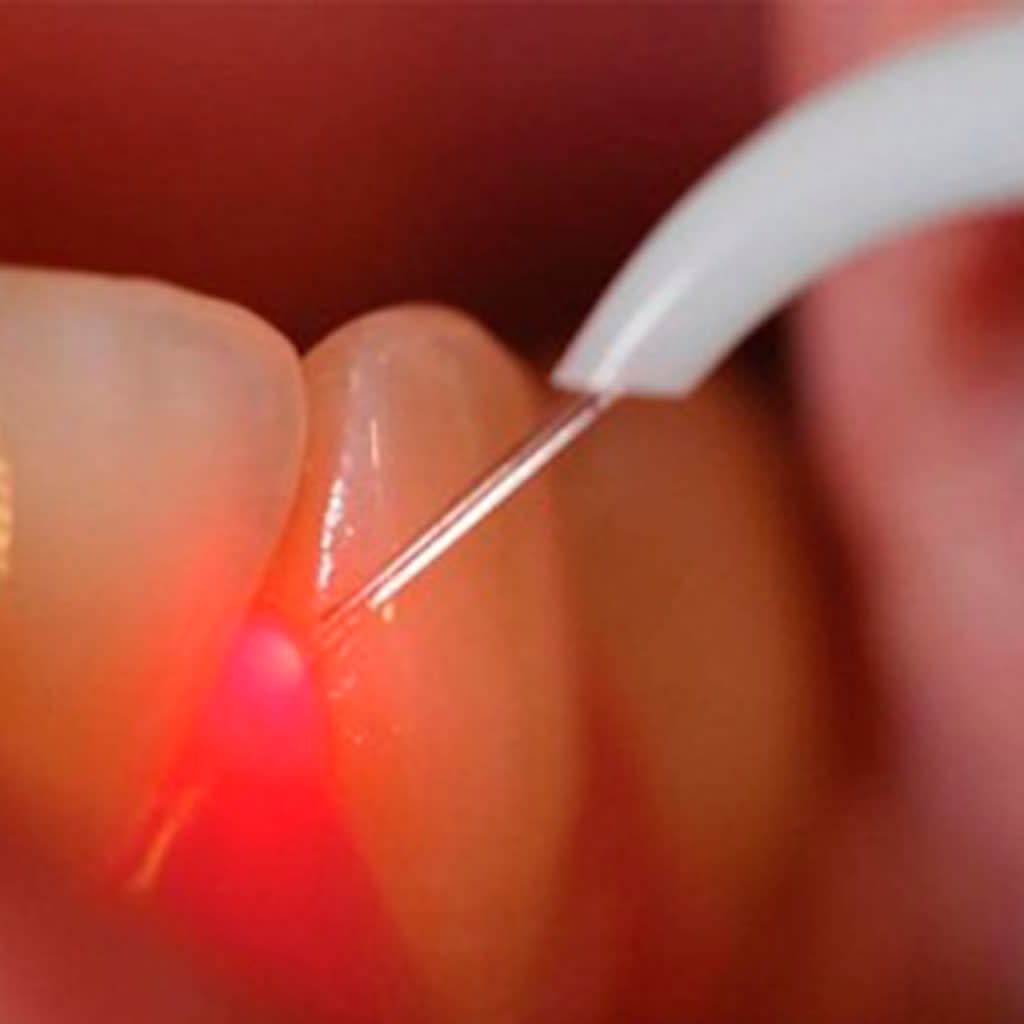 Studio Dentistico Dr. Coler SA gallery image 10