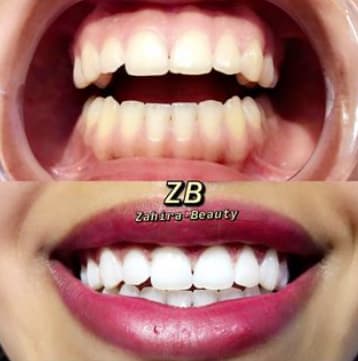 Zahira Beauty Schütz gallery image 8