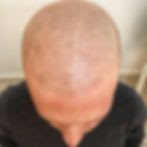 ScalpCare gallery image 1