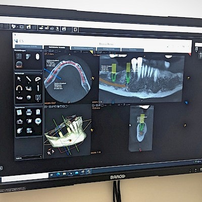 Dr. med. Dr. med. dent. Oliver Lys gallery image 8