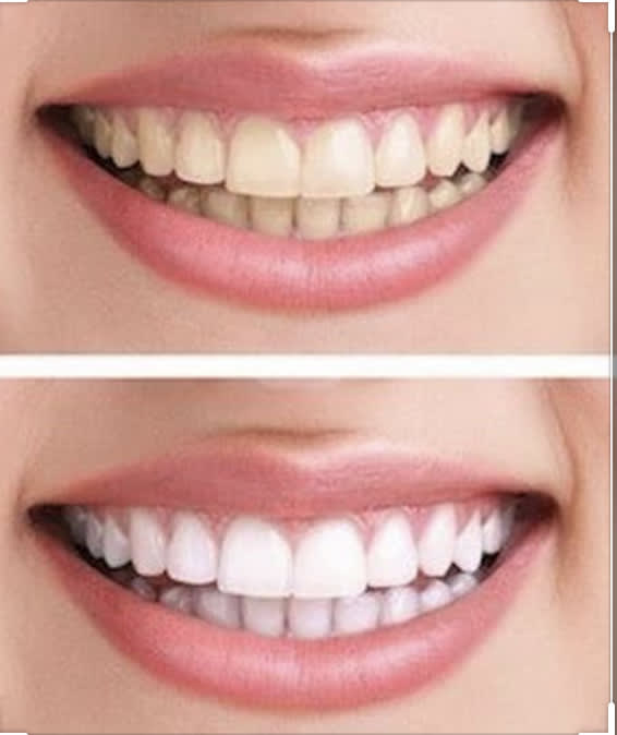 Bleaching Lounge Dream Smile Basel gallery image 3