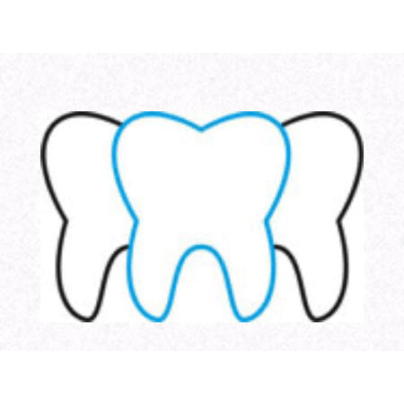 Zahnarzt Luzern Dr. med. dent. Alexandra Rutar gallery image 10