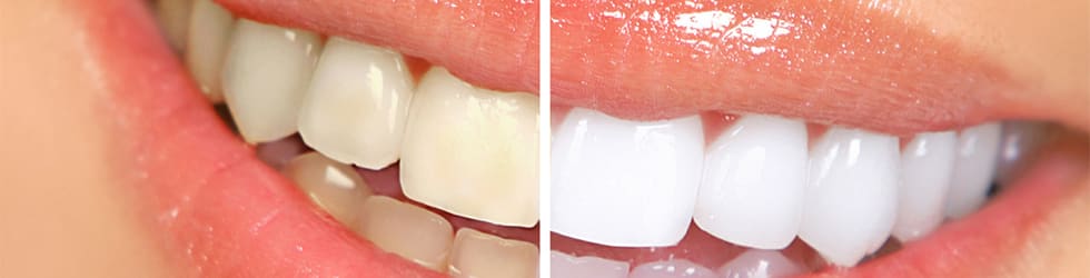 CENTRO DENTALE LUGANO - Studio dentistico, Dentista, Medicina estetica , Bovisa, Ghisolfa gallery image 7