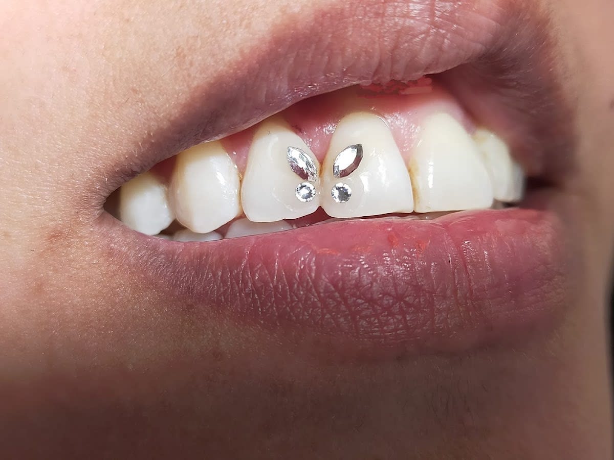 Tout Sourire Hygiéniste dentaire Virginie Brochant gallery image 4