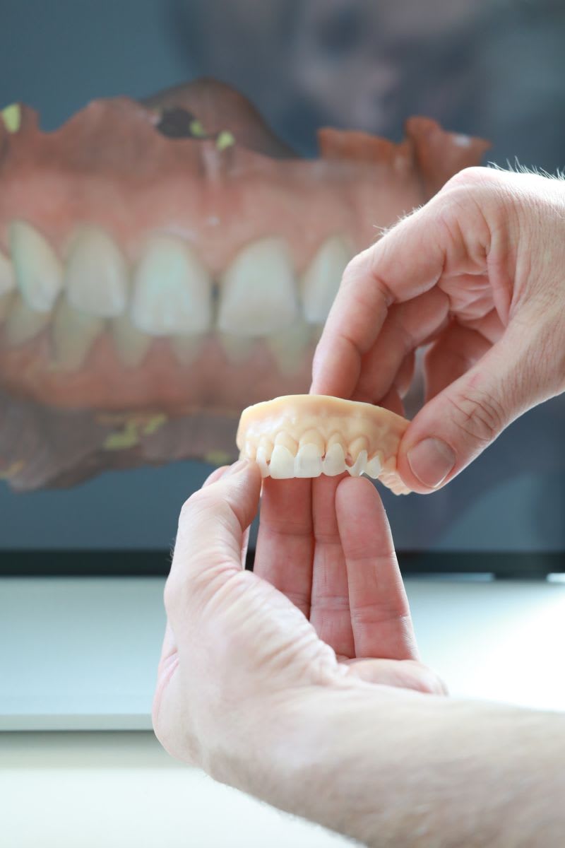 PD Dr. med. dent. Alexis Ioannidis - zahnmedizin.zuerich gallery image 8