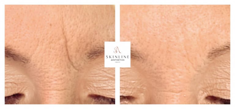 Skinline Aesthetics Swiss –Schönheitsklinik für Ästhetische Medizin und Permanent Make-up | Dr. med. Sascha Dörrmann gallery image 2