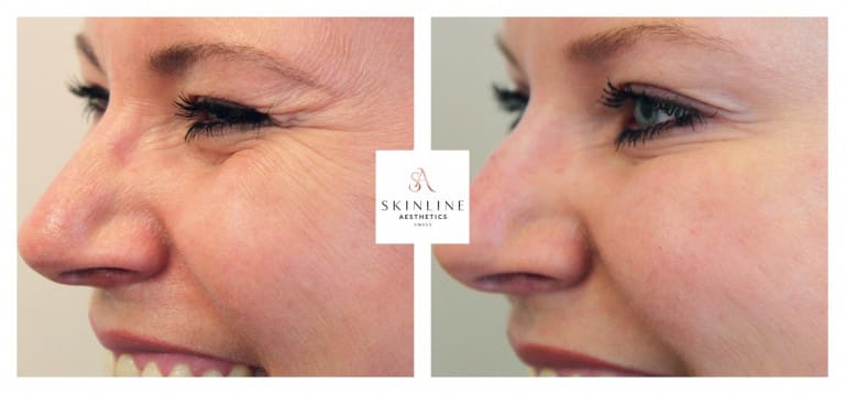 Skinline Aesthetics Swiss –Schönheitsklinik für Ästhetische Medizin und Permanent Make-up | Dr. med. Sascha Dörrmann gallery image 3