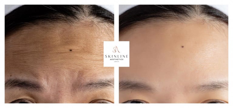 Skinline Aesthetics Swiss –Schönheitsklinik für Ästhetische Medizin und Permanent Make-up | Dr. med. Sascha Dörrmann gallery image 4