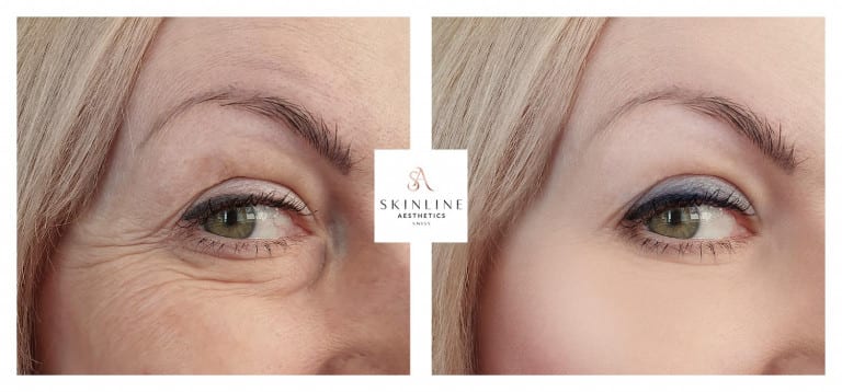 Skinline Aesthetics Swiss –Schönheitsklinik für Ästhetische Medizin und Permanent Make-up | Dr. med. Sascha Dörrmann gallery image 5