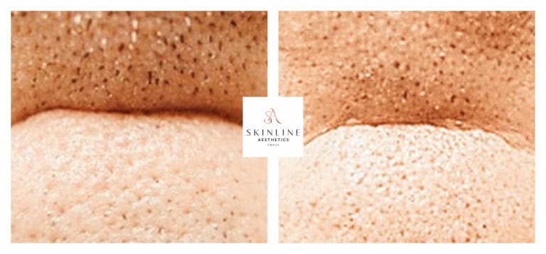 Skinline Aesthetics Swiss –Schönheitsklinik für Ästhetische Medizin und Permanent Make-up | Dr. med. Sascha Dörrmann gallery image 6