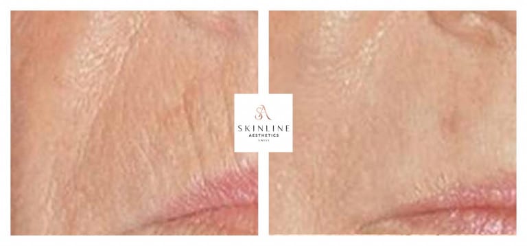 Skinline Aesthetics Swiss –Schönheitsklinik für Ästhetische Medizin und Permanent Make-up | Dr. med. Sascha Dörrmann gallery image 7