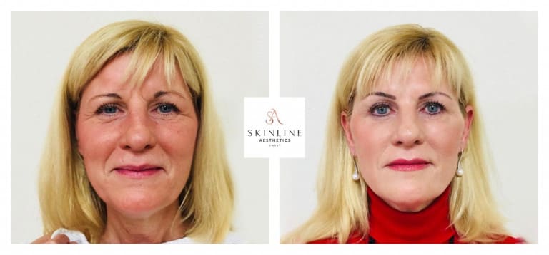 Skinline Aesthetics Swiss –Schönheitsklinik für Ästhetische Medizin und Permanent Make-up | Dr. med. Sascha Dörrmann gallery image 9