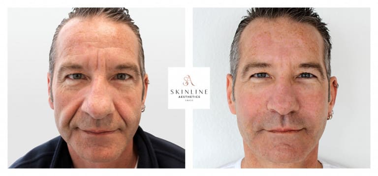 Skinline Aesthetics Swiss –Schönheitsklinik für Ästhetische Medizin und Permanent Make-up | Dr. med. Sascha Dörrmann gallery image 10