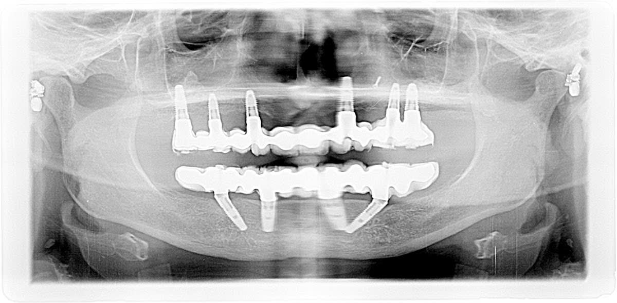Bodensee Implantatzentrum Dr. Wolfgang Prinz MDSc Zahnarzt/ Implantologie gallery image 8