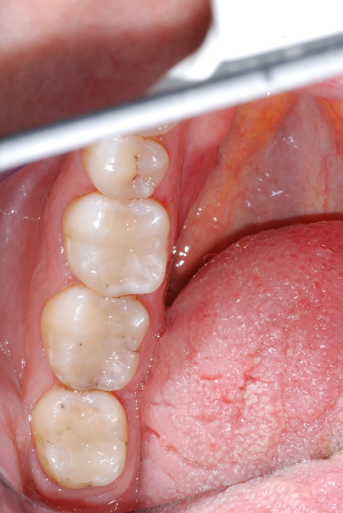 Bodensee Implantatzentrum Dr. Wolfgang Prinz MDSc Zahnarzt/ Implantologie gallery image 10