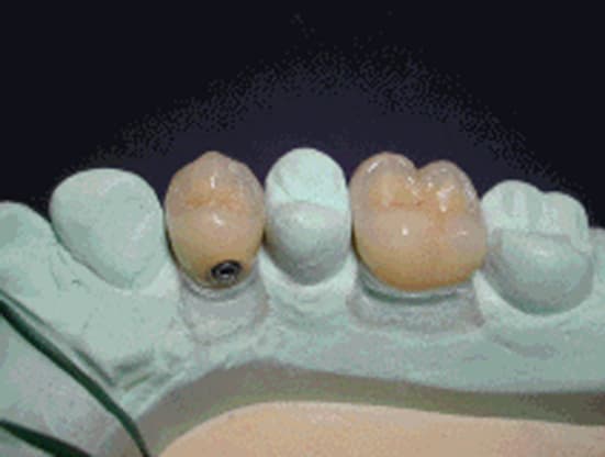 Laboratoire de prothèse dentaire Dunand gallery image 8