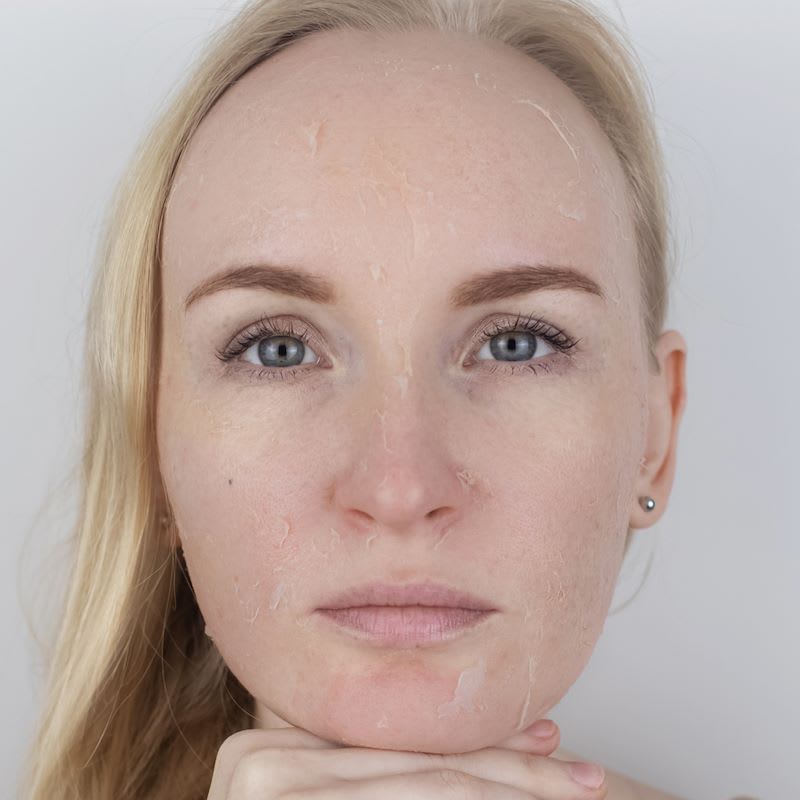 VIVAD Aesthetics Center, Laser Haarentfernung, Zug gallery image 1