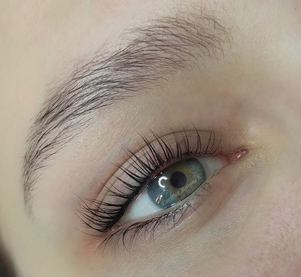 VIVAD Aesthetics Center, Laser Haarentfernung, Zug gallery image 5