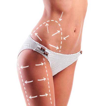 Fettabsaugung Zürich gallery image 2