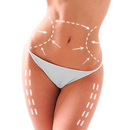 Fettabsaugung Zürich gallery image 3