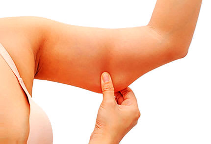 Fettabsaugung Zürich gallery image 4