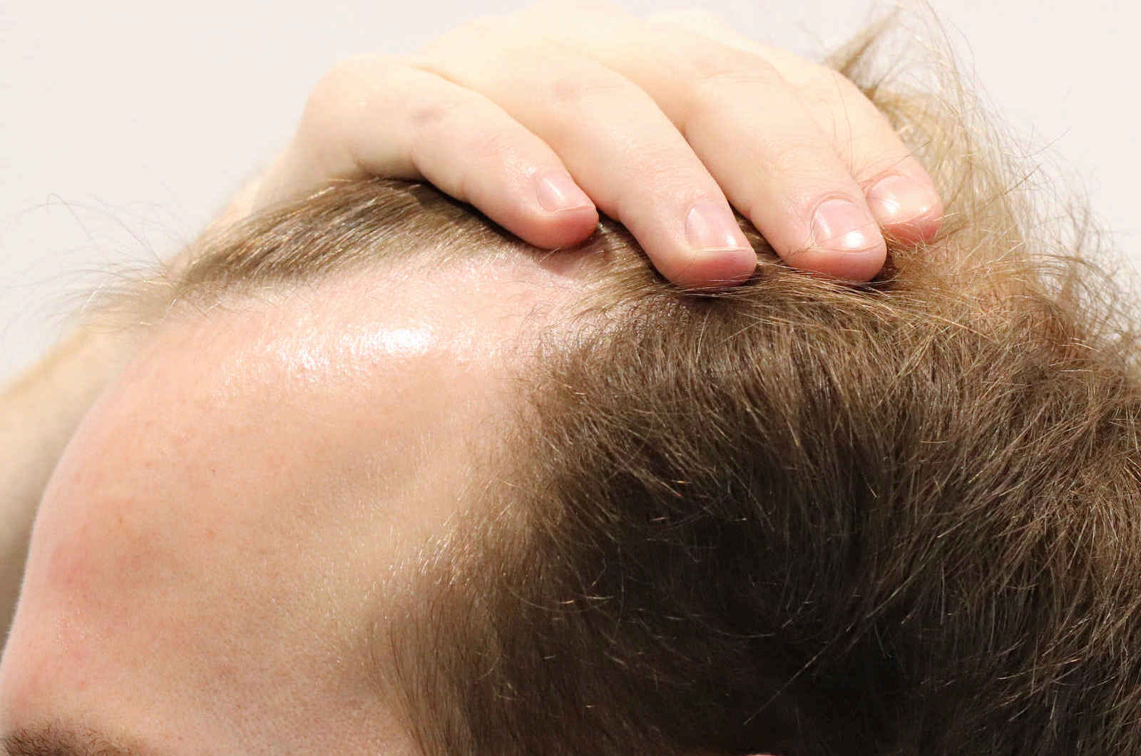 HairIn Clinic - für professionelle Haartransplantation - Est. 2010 gallery image 5