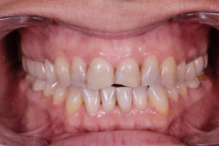 Switeeth - Dr. Jacques Cheylus - Dre Maëva Werlé gallery image 2