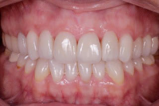 Switeeth - Dr. Jacques Cheylus - Dre Maëva Werlé gallery image 3