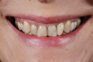 Switeeth - Dr. Jacques Cheylus - Dre Maëva Werlé gallery image 4